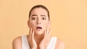 Kondisi jerawat atau acne vulgaris pada wajah yang membutuhkan penanganan dokter spesialis kulit.